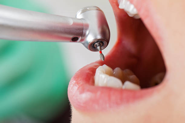 Best Broken or Cracked Tooth Emergency Dentist in Baldwin, PA